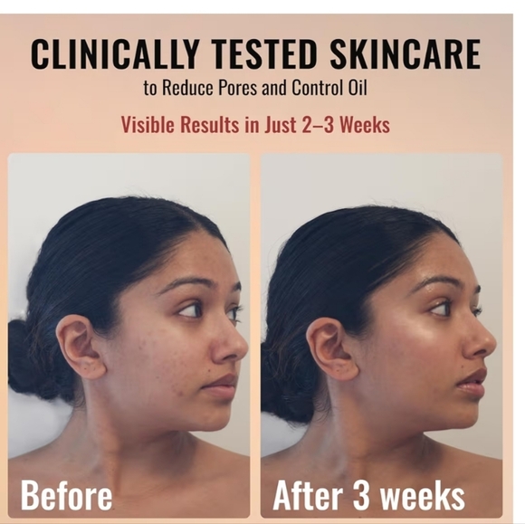 Anti Aging Pure Retinol Serum - Picture 3 of 7